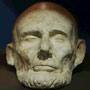 A life mask of President Lincoln shows a large degree of asymmetry in his face.